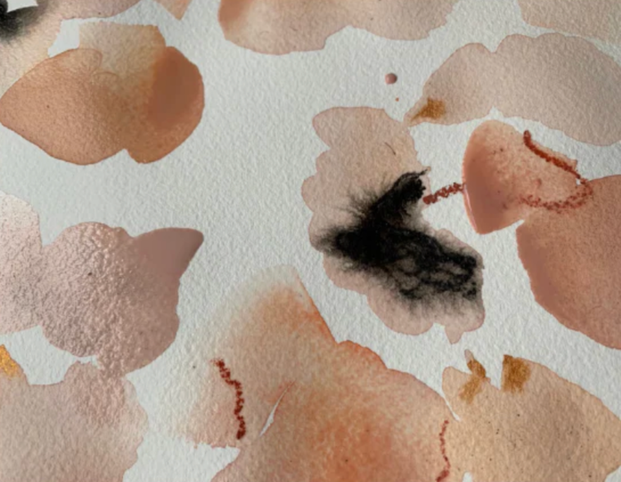 Biofilms and Their Role in Recurrent UTIs