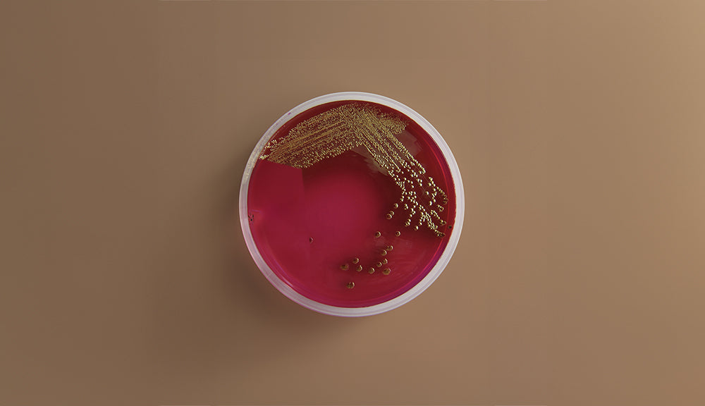 Bacterial culture plate with red agar and gold colonies on a brown background. A laboratory petri dish labeled “E. coli testing” showing visible bacterial growth, indicating a positive bacterial result.