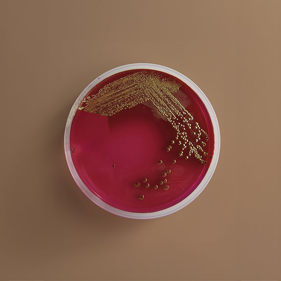 Bacterial culture plate with red agar and gold colonies on a brown background. A laboratory petri dish labeled “E. coli testing” showing visible bacterial growth, indicating a positive bacterial result.
