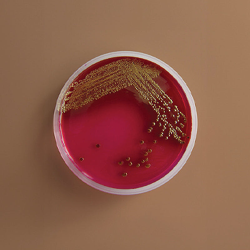 E. coli bacteria colonies growing on agar plate representing UTI-causing bacteria