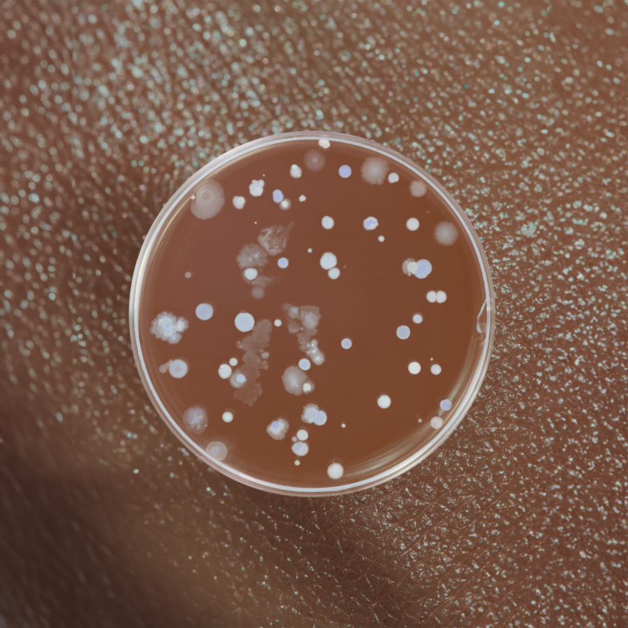 Petri dish showing mixed bacterial colonies representing the microbiome