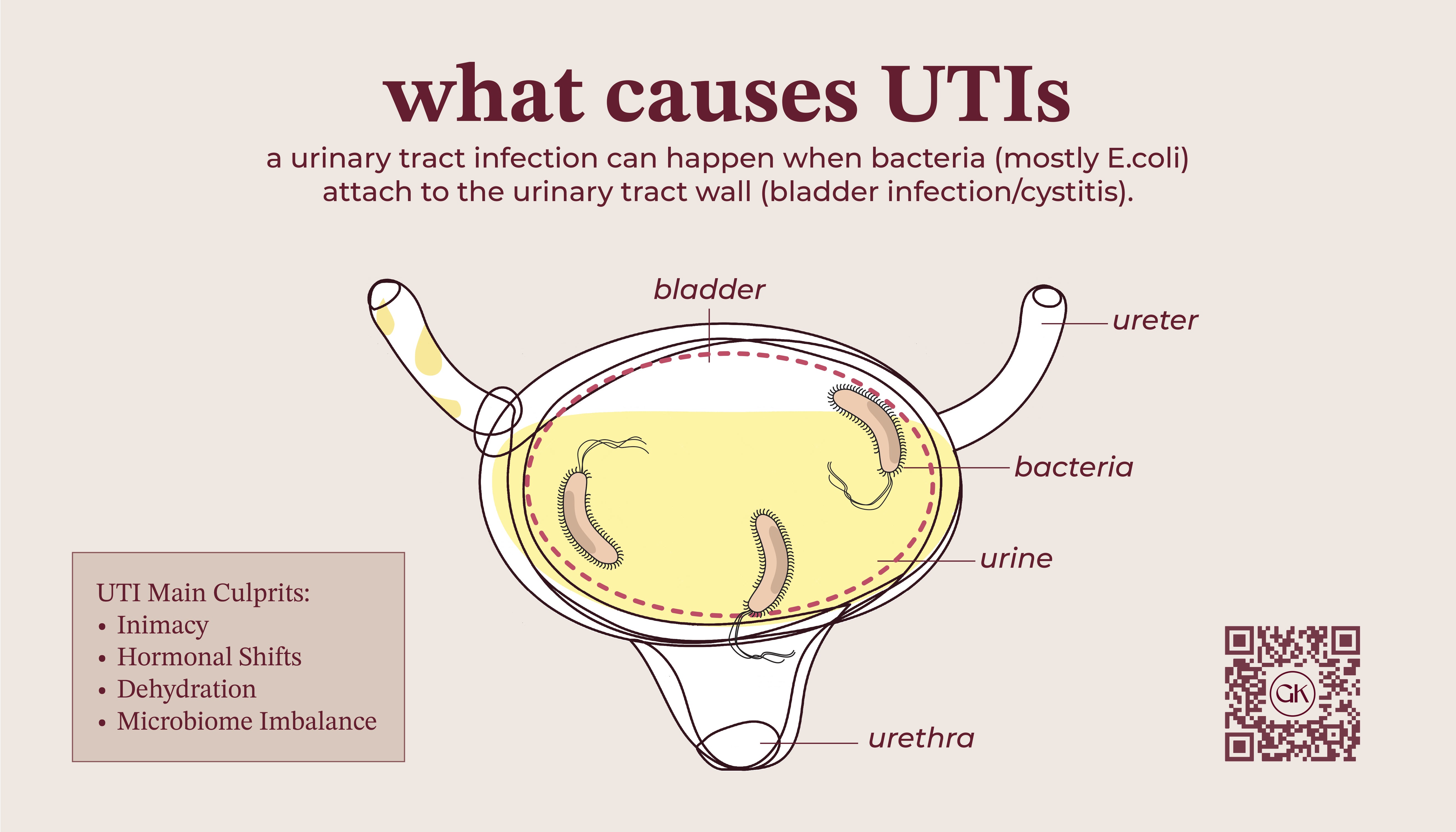 Diagram explaining what causes UTIs with labeled parts of the urinary system.